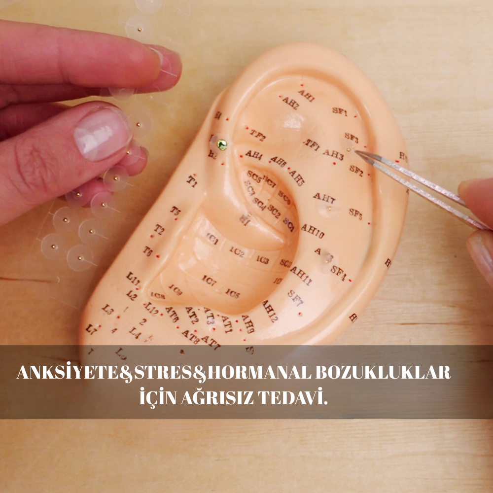 Acuseeds™ – Kulak Akupresür Tohumları Doğal Stres, Anksiyete, Hormon ve İştah Dengesi Desteği